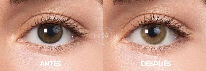 Crooma Antes y Después